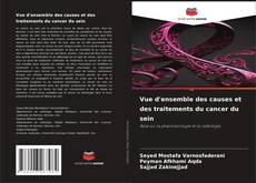 Bookcover of Vue d'ensemble des causes et des traitements du cancer du sein
