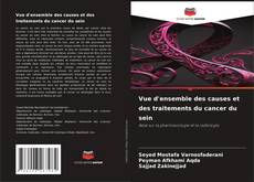 Copertina di Vue d'ensemble des causes et des traitements du cancer du sein
