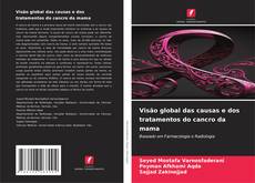 Capa do livro de Visão global das causas e dos tratamentos do cancro da mama 