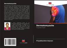 Capa do livro de Dermatomyosite 