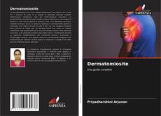 Capa do livro de Dermatomiosite 