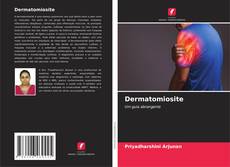 Bookcover of Dermatomiosite