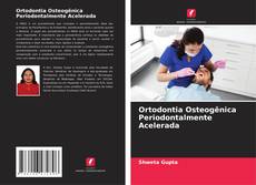 Bookcover of Ortodontia Osteogênica Periodontalmente Acelerada