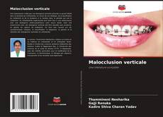Bookcover of Malocclusion verticale