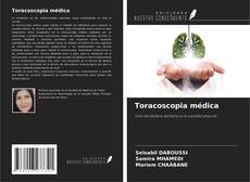Bookcover of Toracoscopia médica