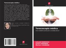Capa do livro de Toracoscopia médica 