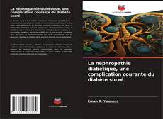 Bookcover of La néphropathie diabétique, une complication courante du diabète sucré