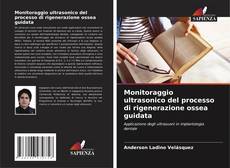 Bookcover of Monitoraggio ultrasonico del processo di rigenerazione ossea guidata