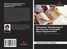 Buchcover von Ultrasonic Monitoring of the Process of Guided Bone Regeneration