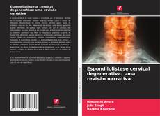 Bookcover of Espondilolistese cervical degenerativa: uma revisão narrativa