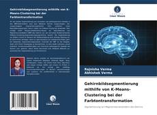 Buchcover von Gehirnbildsegmentierung mithilfe von K-Means-Clustering bei der Farbtontransformation