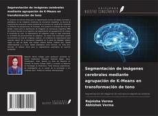 Capa do livro de Segmentación de imágenes cerebrales mediante agrupación de K-Means en transformación de tono 