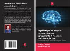 Capa do livro de Segmentação de imagens cerebrais usando agrupamento K-Means na transformação Hue 