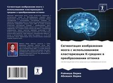 Bookcover of Сегментация изображения мозга с использованием кластеризации K-средних в преобразовании оттенка