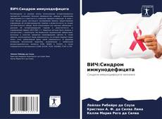Bookcover of ВИЧ:Синдром иммунодефицита