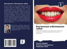 Bookcover of Внутреннее отбеливание зубов