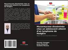 Bookcover of Mucormycose disséminée chez un adolescent atteint d'un lymphome de Hodgkin