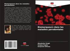 Biomarqueurs dans les maladies parodontales kitap kapağı