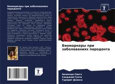 Bookcover of Биомаркеры при заболеваниях пародонта