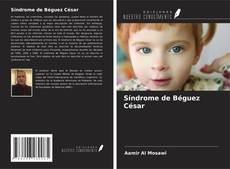 Capa do livro de Síndrome de Béguez César 