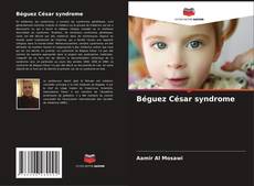 Béguez César syndrome kitap kapağı