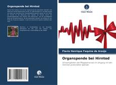 Buchcover von Organspende bei Hirntod
