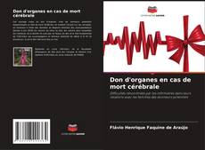 Buchcover von Don d'organes en cas de mort cérébrale