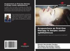 Buchcover von Acupuncture as first-line therapy in herpes zoster ophthalmicus