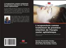 Buchcover von L'acupuncture comme traitement de première intention de l'herpès zoster ophtalmique