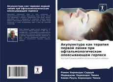 Buchcover von Акупунктура как терапия первой линии при офтальмологическом опоясывающем герпесе