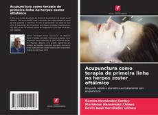 Bookcover of Acupunctura como terapia de primeira linha no herpes zoster oftálmico