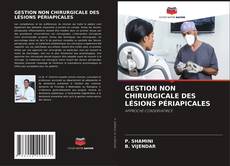 Buchcover von GESTION NON CHIRURGICALE DES LÉSIONS PÉRIAPICALES