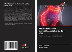 Manifestazioni dermatologiche delle IBD kitap kapağı