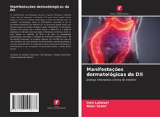 Buchcover von Manifestações dermatológicas da DII