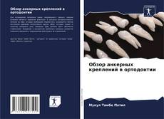 Buchcover von Обзор анкерных креплений в ортодонтии