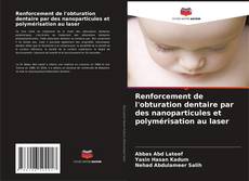 Buchcover von Renforcement de l'obturation dentaire par des nanoparticules et polymérisation au laser