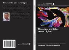 Buchcover von El manual del ictus hemorrágico