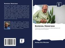 Buchcover von Болезнь Ноногаки