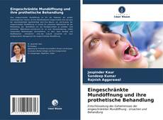 Bookcover of Eingeschränkte Mundöffnung und ihre prothetische Behandlung