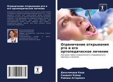 Buchcover von Ограничение открывания рта и его ортопедическое лечение