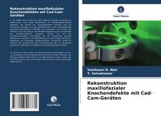 Bookcover of Rekonstruktion maxillofazialer Knochendefekte mit Cad-Cam-Geräten