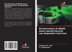 Bookcover of Ricostruzione di difetti ossei maxillo-facciali con dispositivi Cad-Cam
