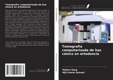 Buchcover von Tomografía computarizada de haz cónico en ortodoncia