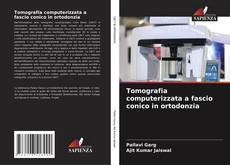 Bookcover of Tomografia computerizzata a fascio conico in ortodonzia