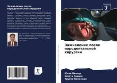 Capa do livro de Заживление после пародонтальной хирургии 