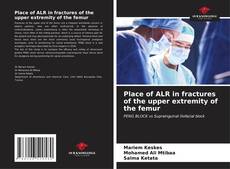 Capa do livro de Place of ALR in fractures of the upper extremity of the femur 