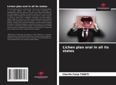 Lichen plan oral in all its states kitap kapağı
