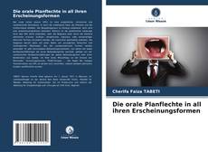 Bookcover of Die orale Planflechte in all ihren Erscheinungsformen