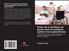 Bookcover of Échec de la prothèse de genou chez les patients opérés d'une gonarthrose