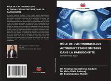 RÔLE DE L'ACTINOBACILLUS ACTINOMYCETAMCOMITANS DANS LA PARODONTITE的封面